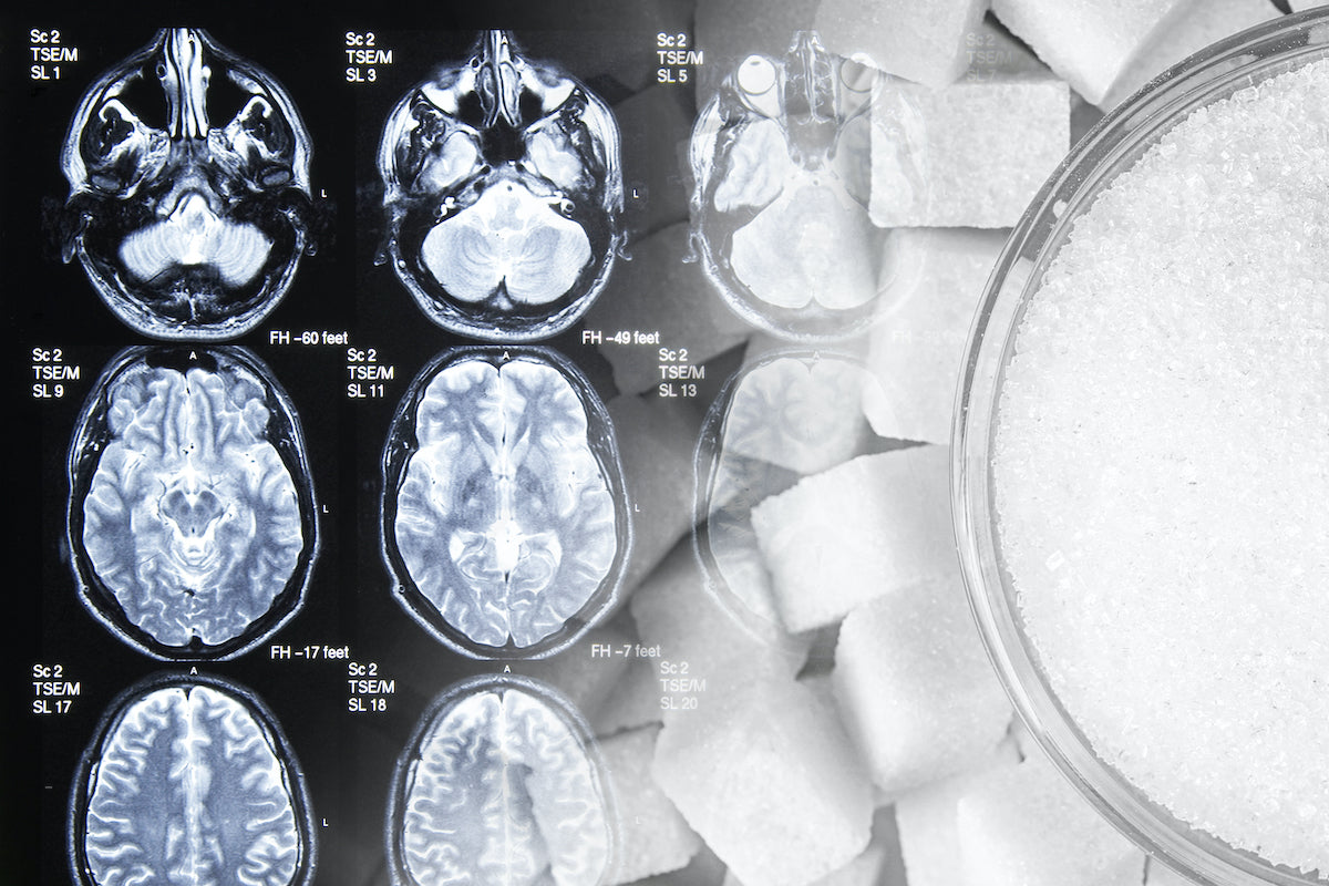 How Does Too Much Sugar Destroy Your Health?